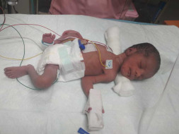 Help My Baby Recover In NICU