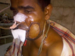 Support Mukesh Kumar Singh recover from Oral Cancer