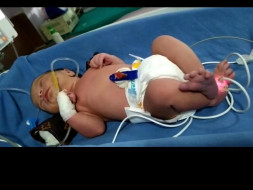 Help Baby of Nitin kumar Fight Prematurity