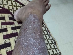 Help Me for My Medical Expenses