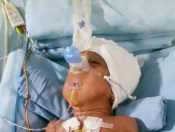 1 year old Diya needs your help for Liver transplant