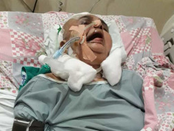 Help My Wife Usha Uttam Recover From Road Accident