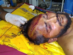 Help sourabh to Fight with head injury