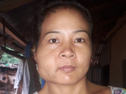 Help My Relative Fight Hemorrhagic Stroke