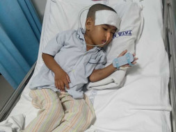4 Years Old Amar Needs Your Help To Fight Brain Tumor