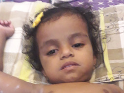 Sayana Krishna Needs Your Support To Fight Multiple Intestinal Atresia