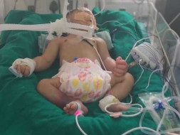 4 Days Old Baby Of Munera Needs Your Help Fight Neuro Disease