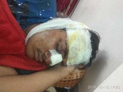 Help Me And My Son Recover From Accident