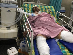 Support Someshekhar B K Recover From Accident