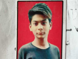 My Cousin Met With Electrocution Accident, Help Him