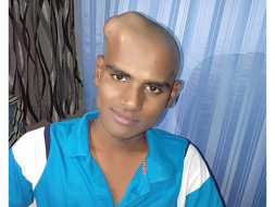 23 Years Old Arun Kumar Needs Your Help To Fight Brain Tumor