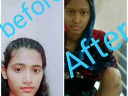15 Years Old Swapna Needs Your Help Fight Bone Cancer