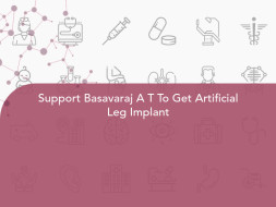 Support Basavaraj A T To Get Artificial Leg Implant