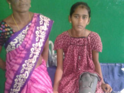14 Year Old Nagalakshmi Needs Your Help To Fight Bone Cancer
