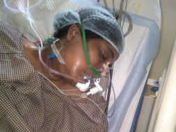 This 35 year old need your urgent support in fighting fungal infection