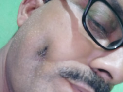 Help Me Fight Mouth Cancer