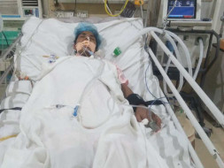 23 Years Old Iklesh Kumari Needs Your Help Fight Liver Damage & Brain Fever