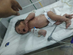 Help to baby of jyoti urgently treatment