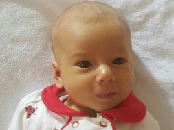 4 Months Old Firdavsa Bhakhabova Needs Your Help Fight Biliary Atresia