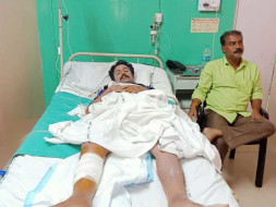My Relative Is Struggling From Leg Fracture, Help Him