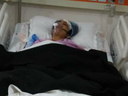 Help My Friend Reena Recover From Bilateral Fracture