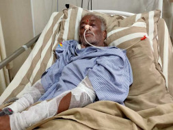 Nanjunde Is Struggling With Brain Stroke And Lungs Issue. Help Him