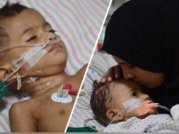 Help My Daughter Recover from Tumor.
