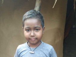 10 Years Old Krish Mallick Needs Your Help Fight Lupus