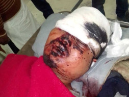 Help Mehboob Hussain Recover