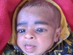 Support Rishabh Nisad Recover From Valvular Heart Disease