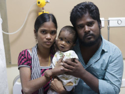 8 Months Baby Vignesh Suffering From Congenital Heart Disease