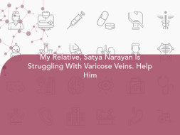 My Relative, Satya Narayan Is Struggling With Varicose Veins. Help Him