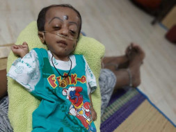 5 Months Old Gabriel Marcus Nelson Needs Your Help Recover From Heart Blockage