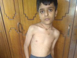 12 years old Lakshya Dugar needs your help .