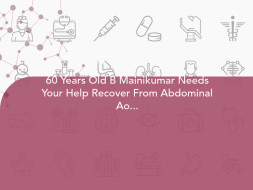 60 Years Old B Mainikumar Needs Your Help Recover From Abdominal Aortic Aneurysm