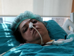 Help my mother. She is suffering from GBS.