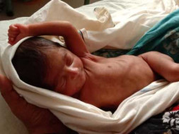 Help The Prematurely Born Twins, Fatherless Before Birth.