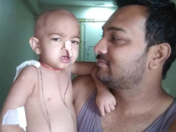 2 Years Old Paakhi Needs Your Help Fight Leukemia (Blood cancer)