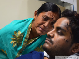 Help My Brother Sathish to recover from Road Accident