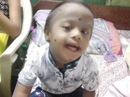 3 Years Old Tejas Ajay Gaikar Needs Your Help Fight Down Syndrome