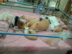 9 days old baby requires your help to survive.