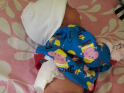 Newborn Baby is fighting for Spinal Cord Surgery to live