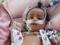 8 Months Old Mintu Needs Your Help Fight HLM secondary