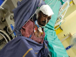 Help To 45yrs old poor man diagnosed as RTA HEAD INJURY . DM FRACTURE
