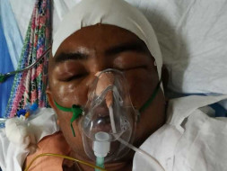 Help My Cousin Fight Brain Haemorrhage
