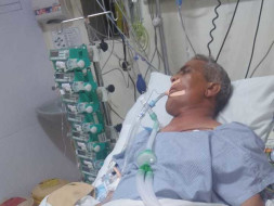 57 Years Old Thakur Prasad Needs Your Help Fight Oral Cancer