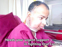 This 40 years old needs your urgent support in fighting Oral Cancer