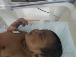 Support Baby of Gauri To Recover From Myocardial Ischemia
