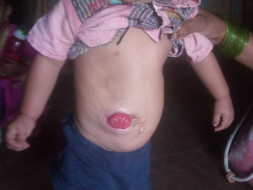 My Friend Son Is Struggling With Stomach Diseases, Help Him