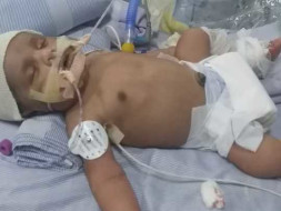 Help Me To Save My Baby. He Needs To Undergo Liver Transplant.